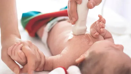 A sonographer performs a cardiovascular sonography on an infant as parent holds baby's hand.