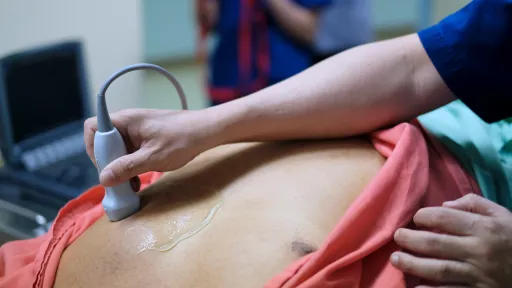 Echocardiographer exams adult.