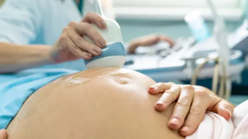 Ultrasound technician performing prenatal scan with handheld transducer on pregnant patient
