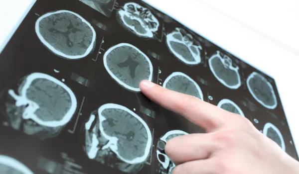 Concorde radiology