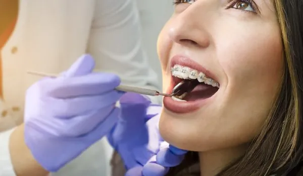 Dental Hygienist working in teeth