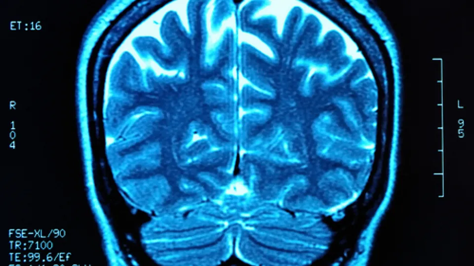 Electroneurodiagnostic neurodiagnostic technology, concorde career college,