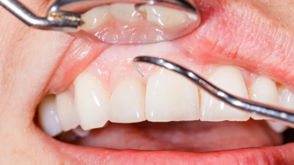 Dental Health Dental Health