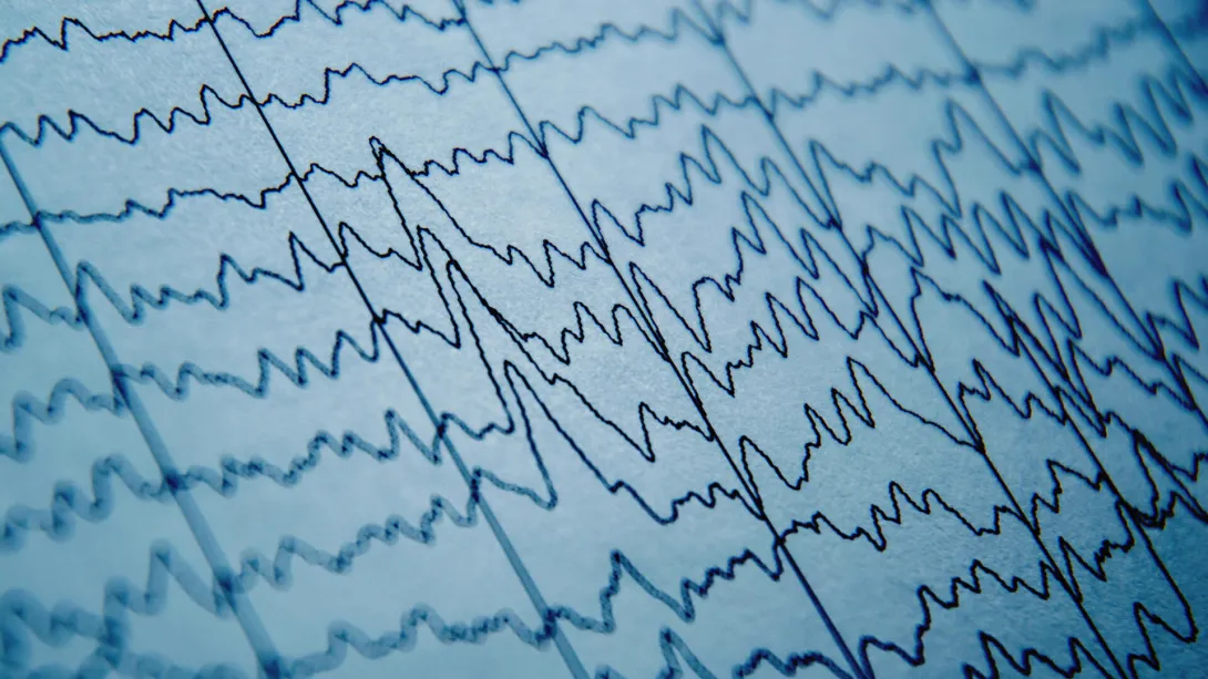 EEG test brain wave pattern